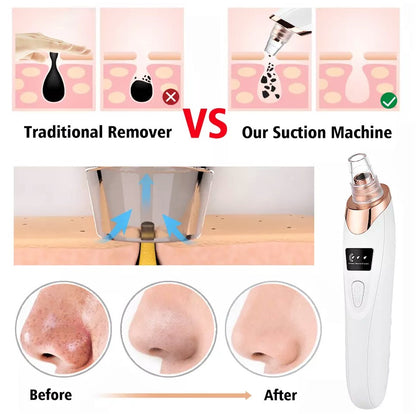 5 in 1 Electric Rechargeable Black Head Remover Machine