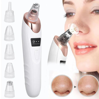 5 in 1 Electric Rechargeable Black Head Remover Machine